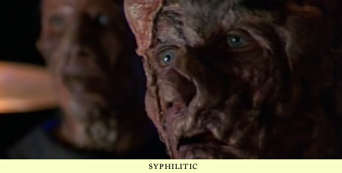syphilitic vidian